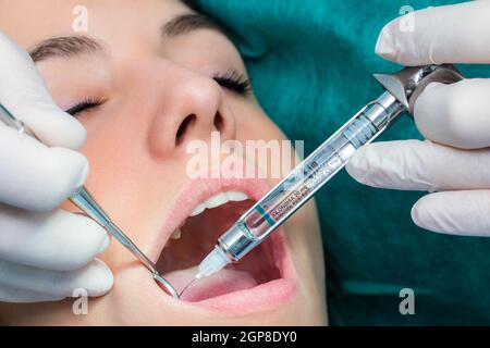 Macro close up del giovane ragazza la ricezione di anestesia con siringa medica.Dentista ago di iniezione a bocca aperta. Foto Stock