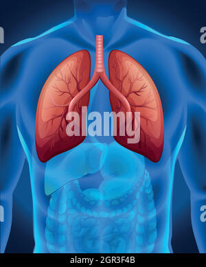 Cancro polmonare nell'uomo Illustrazione Vettoriale
