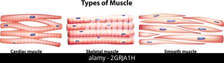 Tipi di muscoli Illustrazione Vettoriale