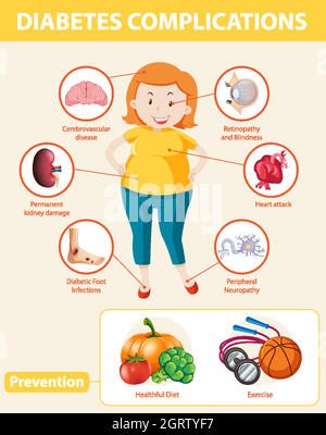 Infografica medica delle complicazioni e delle prevenzioni del diabete Illustrazione Vettoriale