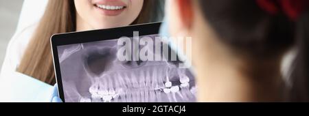 Il medico dentista esamina l'immagine radiologica sullo schermo del tablet nella sedia è paziente di donna Foto Stock