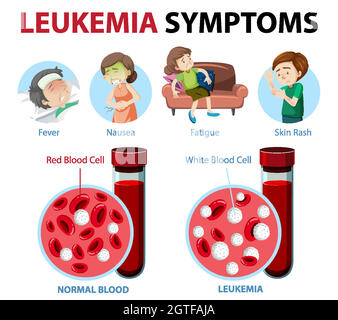 Infografica stile cartoon sintomi leucemia Illustrazione Vettoriale
