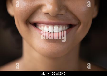 Primo piano felice giovane afroamericana donna mostrando sano sorriso. Foto Stock