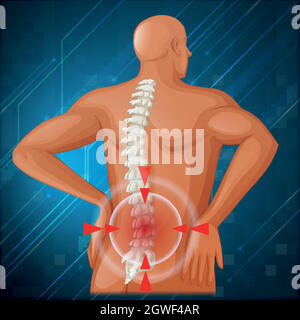 Diagramma della colonna vertebrale che mostra dolore alla schiena Illustrazione Vettoriale