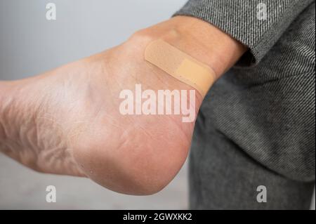 Una donna sigilla un granoturco sulla gamba con un gesso. La ragazza le sfregò la gamba con scarpe scomode. Foto Stock