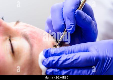 Pulizia meccanica del viso, pulizia della pelle dalle impurità superficiali e profonde. Novità Foto Stock