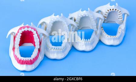 Dentista denti ortodontico modelli con ganasce aperte su sfondo blu Foto Stock