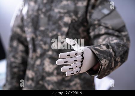 Mano dell'arto protesico artificiale Soldier. Veterano di guerra Foto Stock