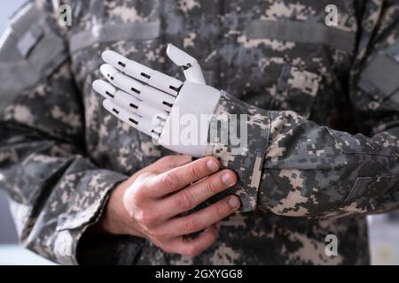 Mano dell'arto protesico artificiale Soldier. Veterano di guerra Foto Stock