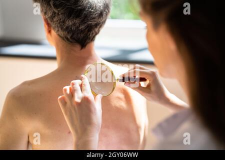 Dermatologo che verifica i problemi di allergia e di pigmento della pelle Foto Stock