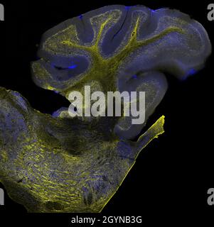 Sezione sagittale del cervelletto murino marcato con immunofluorescenza e visualizzato con microscopia a scansione laser confocale. Grandi cellule di Purkinje Foto Stock