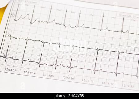 Primo piano di ECG, elettrocardiogramma. Il lavoro di un cuore sano sulla carta. Foto Stock