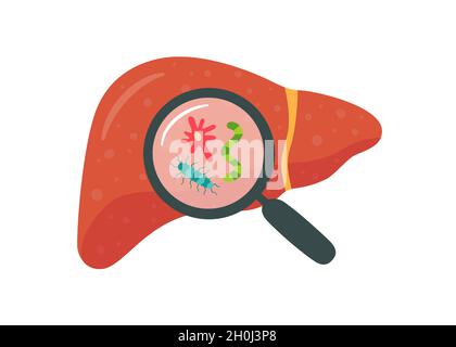 Fegato e lente di ingrandimento con vermin. Malattia del fegato. Illustrazione vettoriale isolata in stile piatto su sfondo bianco Illustrazione Vettoriale
