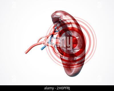 Illustrazione anatomicamente accurata in 3d della milza d'organo interna umana con arteria dei vasi sanguigni e vene con malattia isolata su bianco Foto Stock