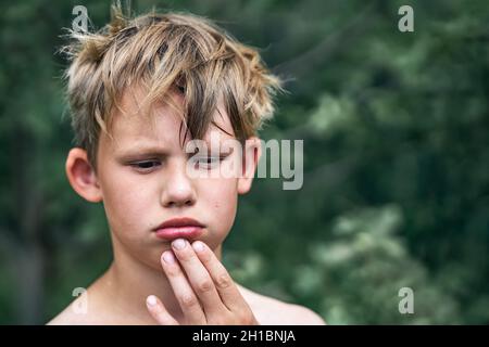 Ragazzo sconvolto con capelli biondi sudicio tocca labbro inferiore ferito dalle dita in piedi nel parco verde sulla bella vista giorno d'estate vicino Foto Stock