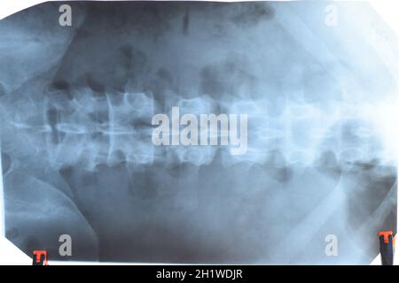 X-ray del rachide lombare della colonna vertebrale, sui raggi x Foto Stock