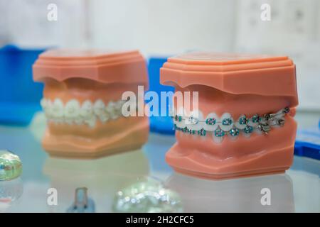 Mandibole anatomiche umane con bretelle ortodontiche, staffe in metallo e ceramica Foto Stock