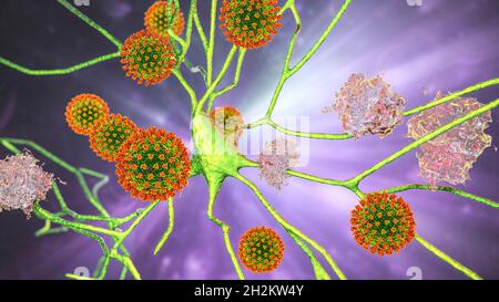 Eziologia infettiva della demenza, illustrazione concettuale Foto Stock