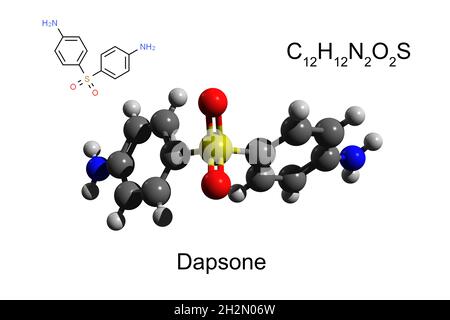 Formula chimica, formula strutturale e modello 3D a sfera e bastone di un dapsone antimicrobico, fondo bianco Foto Stock
