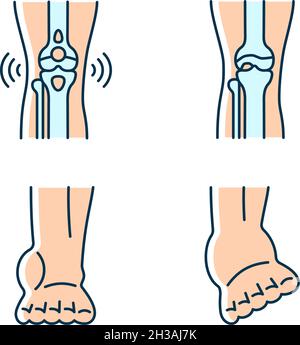 Artrite dolore alle gambe RGB icone di colore impostato Illustrazione Vettoriale