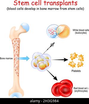 Trapianti di cellule staminali le cellule del sangue si sviluppano nel midollo osseo da cellule staminali, eritrociti, leucociti e piastrine Illustrazione Vettoriale