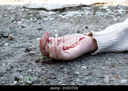 la mano di un uomo nel sangue giace sull'asfalto sulla strada dopo un incidente d'auto. Foto Stock