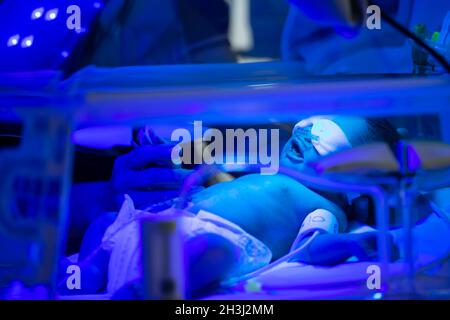 Bambino neonato che ha un trattamento per l'ittero sotto luce ultravioletta in incubatore. Un'unità di terapia intensiva neonatale (NICU), un nursery di terapia intensiva Foto Stock