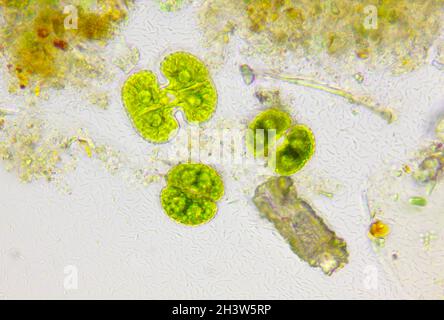 Vista microscopica del detrito con alghe (Cosmarium) e batteri. Illuminazione a campo chiaro. Foto Stock