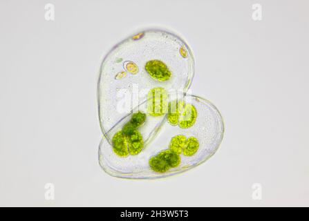 Vista microscopica delle alghe verdi (Cosmarium) all'interno del guscio vuoto di Ostracod. Illuminazione a campo chiaro. Foto Stock