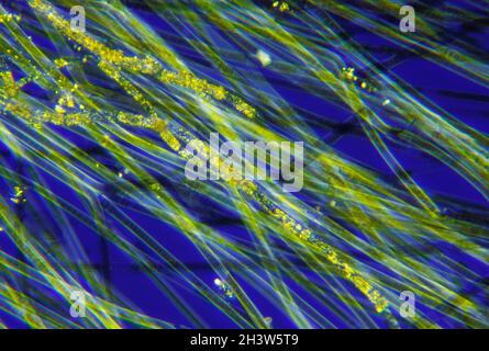 Vista microscopica di filamenti di cianobatteri (alghe blu-verdi, Oscillatoria). Luce polarizzata con polarizzatori incrociati. Foto Stock