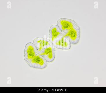 Vista microscopica di due alghe verdi (Cosmarium). Illuminazione a campo chiaro. Foto Stock