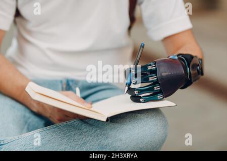 Il giovane uomo disabile scrive nel taccuino con la penna in mano protesica artificiale. Foto Stock