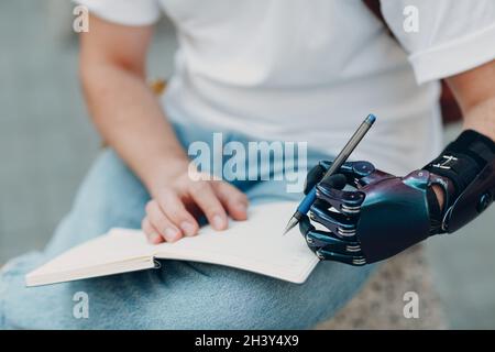 Il giovane uomo disabile scrive nel taccuino con la penna in mano protesica artificiale. Foto Stock