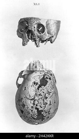 Cheselden, Osteografia, impressione senza lettere. Foto Stock