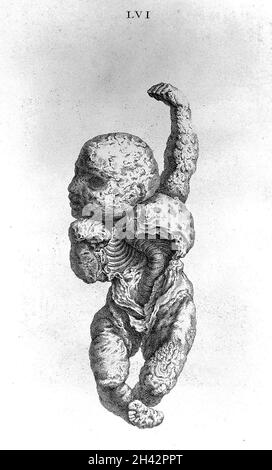 Cheselden, Osteografia, impressione senza lettere. Foto Stock