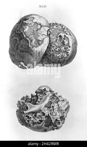 Cheselden, Osteografia, impressione senza lettere. Foto Stock