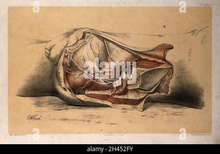 Dissezione del bacino e dell'addome di un uomo, che mostra le arterie, vasi sanguigni e muscoli: Vista laterale. Litografia di G.H. Ford, 1866. Foto Stock