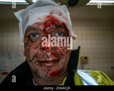 Ritratto di un uomo ferito in faccia in un incidente. Foto Stock