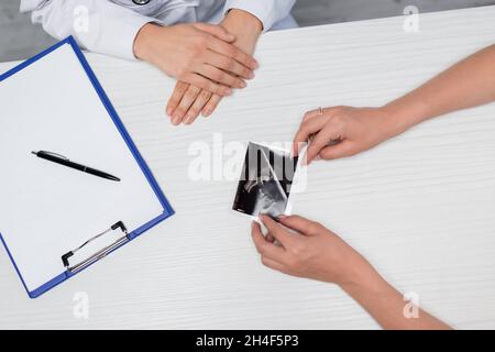 vista parziale del medico e della donna in prossimità della scansione ecografica con conferma della gravidanza e appunti vuoti sulla scrivania Foto Stock