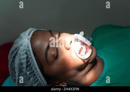 Primo piano paziente donna presso il dentista con bocca aperta grande con riavvolgitore dentario labbro Foto Stock