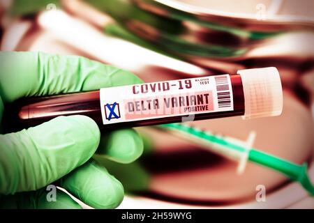 Blutprobe mit Coronavirus Delta-variante B.1.617.2, Symbolfoto Foto Stock