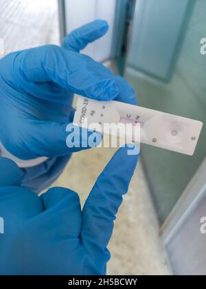 Operatore sanitario che punta il test rapido dell'antigene COVID-19. Risultato positivo Foto Stock