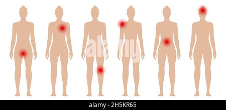 Silhouette donna con puntini rossi in diverse parti del corpo. Illustrazione vettoriale di dolori e dolori femminili. Illustrazione Vettoriale