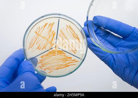 Il medico ha aperto il coperchio di una piastra Petri, coltura pura di lievito su un terreno nutriente, batteri di analisi in laboratorio, primo piano. Foto Stock