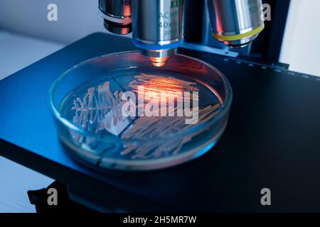 Batteri in una piastra Petri sotto l'ingrandimento degli obiettivi del microscopio, il primo piano. Concentratevi sulle colonie batteriche con luce rossa. Foto Stock