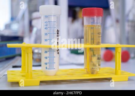 Due provette per centrifuga grandi con sostanze biologiche bianche e gialle, provette in un rack da laboratorio su un desktop da laboratorio Foto Stock