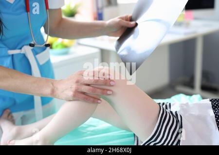 Medico donna che tiene la radiografia ed esamina la gamba del bambino Foto Stock