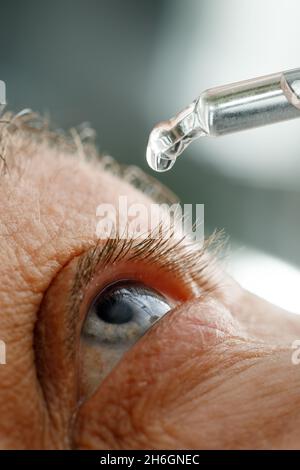 Un uomo inumidisce gli occhi prima di installare le lenti a contatto. Gocce negli occhi da irritazione, arrossamento e allergie. Foto Stock