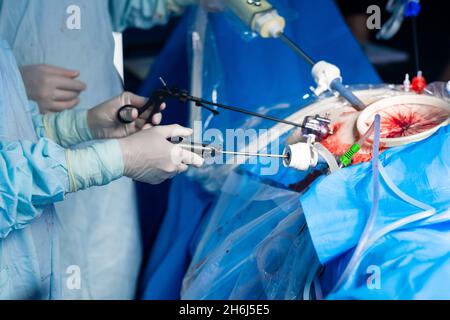 Fuoco selettivo sulla mano di un chirurgo con un manipolatore laparoscopico. Intervento laparoscopico minimamente invasivo con l'uso di un trequarti. Foto Stock