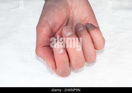 Primo piano di una mano caucasica femminile con unghie naturali non lucidate, cuticole sopravolte su sfondo bianco, vista dall'alto, spazio di copia. Unghie naturali conce Foto Stock